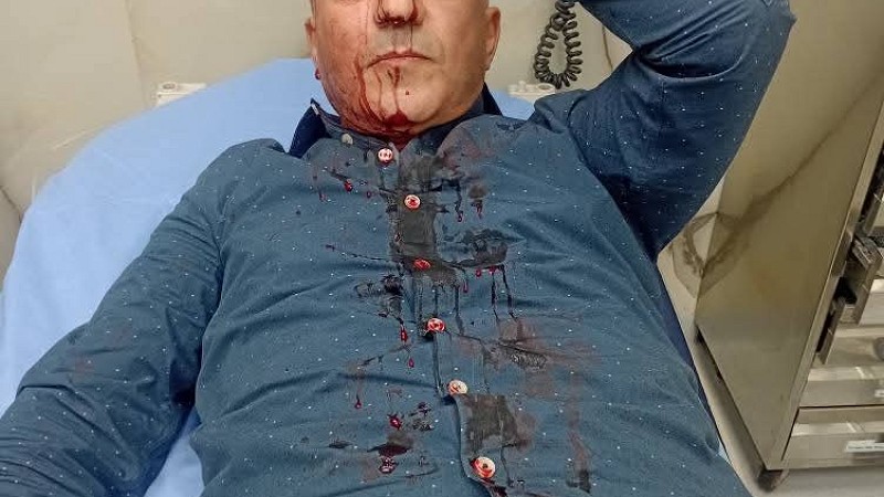 الزميل فارس الحباشنة يتعرض لاعتداء أمام منزله في عمّان